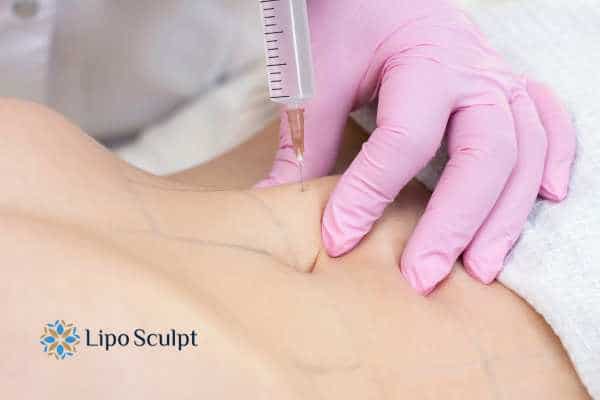 Aqualyx for Muffin Tops: What to Know Before Fat-Dissolving Injections 4 Are there risks Aylesbury?
